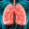 Akciğer kanserinin 8 önemli belirtisine dikkat!
