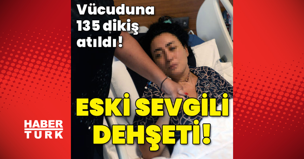 Eski sevgili dehşeti! Vücuduna 135 dikiş atıldı!