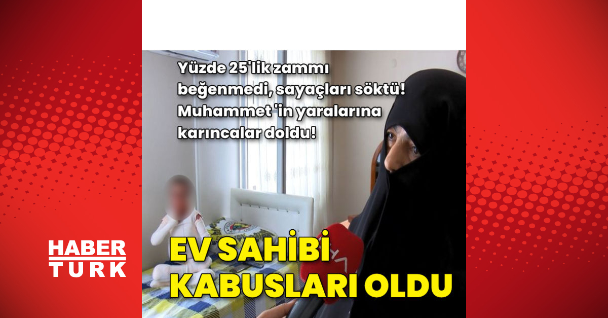 Ev sahibi kabusları oldu! Kelebek hastası çocuğuyla yaşayan kadına ev sahibinden darp iddiası