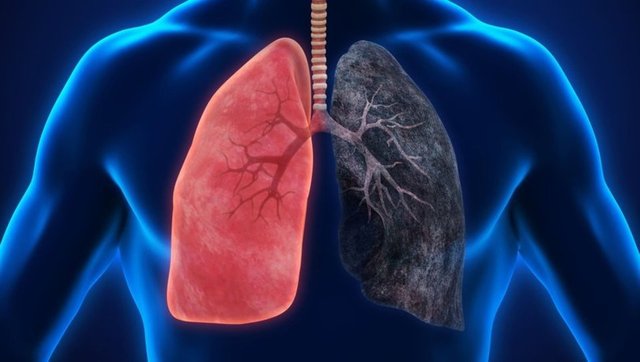 Akciğer kanserinin 8 önemli sinyaline dikkat!