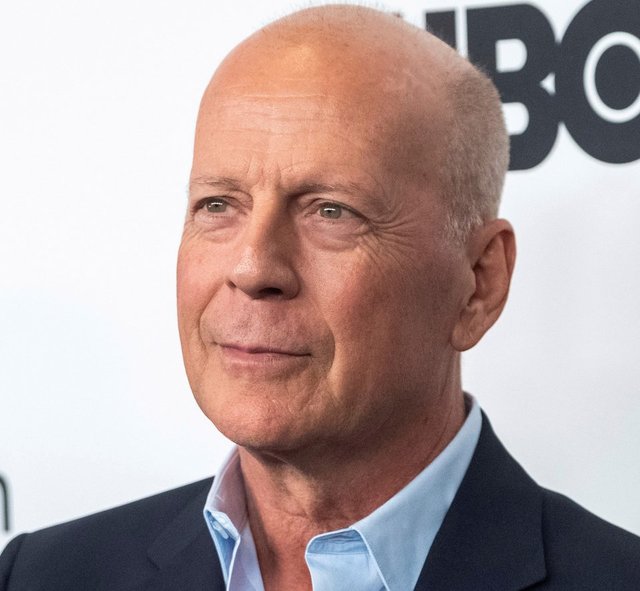 Bruce Willis'in son durumu ortaya çıktı! 'Afazi' hastalığına