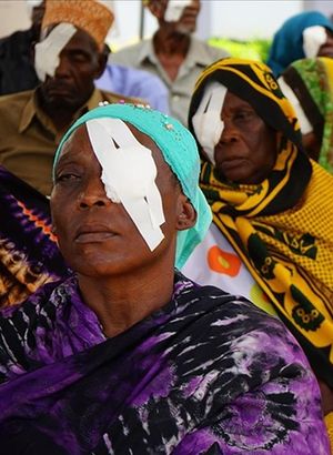 Yeryüzü Doktorları katarakt hastalığına "Aç Gözlerini" kampanyasıyla dikkati çekecek