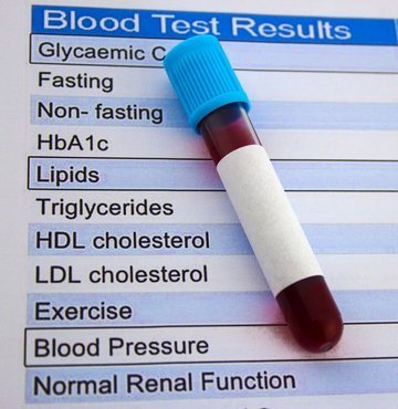 Leptin, vÃ¼cut aÄÄ±rlÄ±ÄÄ±nÄ±n dÃ¼zenlenmesinde yer alan bir hormondur. Leptinin adÄ±, iÅtah dÃ¼zenleme ve termojenez (yaÄÄ±n yakÄ±ldÄ±ÄÄ± sÃ¼reÃ§) yoluyla vÃ¼cut aÄÄ±rlÄ±ÄÄ±nÄ± kontrol etmedeki bariz rolÃ¼nden dolayÄ± Yunanca âinceâ anlamÄ±na gelen leptos kÃ¶kÃ¼nden tÃ¼remiÅtir. Peki, leptin hormonu nedir? leptin hormonu nasÄ±l hÄ±zlÄ± Ã§alÄ±ÅÄ±r?
