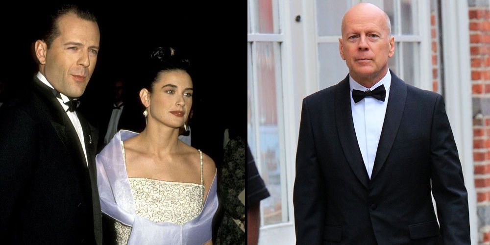 "Bruce Willis'in hastalığı ilerledi"