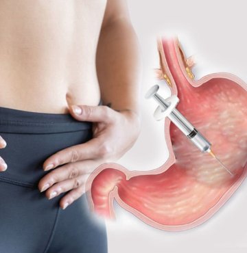 Mide botoksunda merdiven altı uygulamalara karşı uyarılarda bulunan Türk Obezite Cerrahisi Vakfı Başkanı Prof. Dr. Oktay Banlı, hastaya kullanılan botoksun ve dozun çok önemli olduğunu söyledi. Banlı, mide botoksu yaptıranlarda, ateş, bulantı, kusma ve şişkinlik gibi şikayetler meydana geldiğinde en yakın sağlık merkezine gitmeleri gerektiğini söyledi. Habertürk