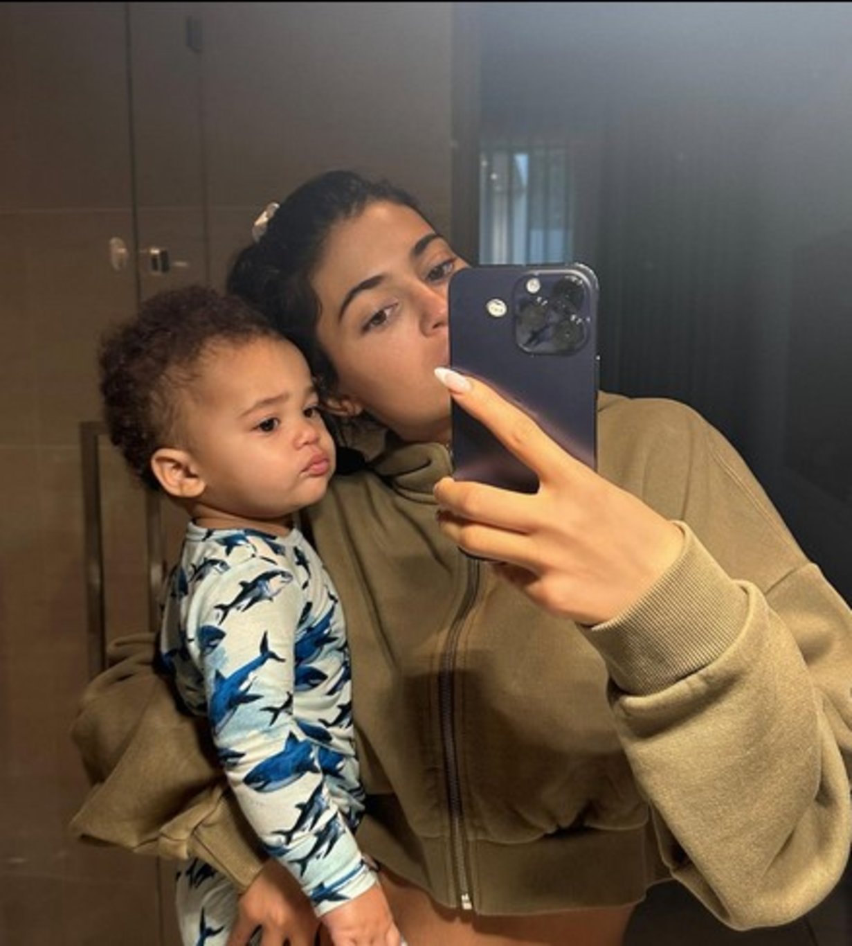 Kylie Jenner: Yüzümün tamamı estetikli değil - Magazin haberleri