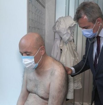 Yaklaşık 45 yıldır, günde en az 3 paket sigara bitirdiğini söyleyen 59 yaşındaki Reşat Yasıboğa, 1 yıl arayla hem akciğer hem de yemek borusu kanserine yakalandı. 2 kanseri de erken evrelerde fark edilen hasta, girdiği 2 ayrı kapalı ameliyatla kanseri yendi. Kişilerde 1 yıl arayla 2 ayrı kanser görülmesinin dünyada çok nadir görülen bir durum olduğunu belirten Göğüs Cerrahisi Uzmanı Prof. Dr. Celalettin İbrahim Kocatürk, “Tıp literatürüne bakıldığında çok nadir görülen bir durum. Akciğer kanserinin ardından yemek borusu kanseri olması, her ikisinin de erken teşhis edilip kapalı yöntemle ameliyat edilebilmesi ise çok çok nadir bir durum” dedi