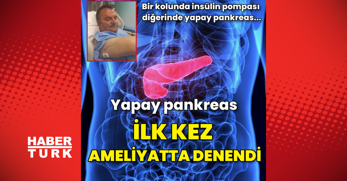 Türkiye’de ilk kez ameliyat sırasında yapay pankreas test edildi!