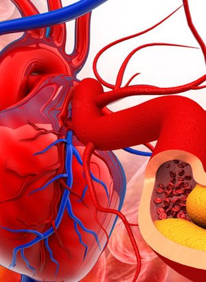 Kolesterolü düşürerek, kalp krizini önlüyor! İşte damarları açarak kalbe iyi gelen süper besinler