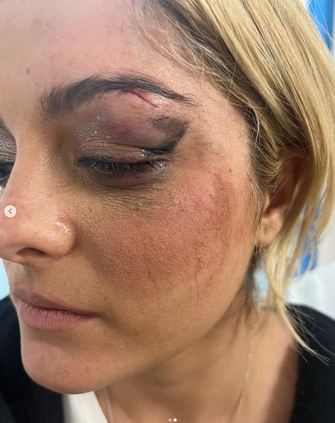 Bebe Rexha'ya sahnede telefonlu saldırı - Magazin haberleri