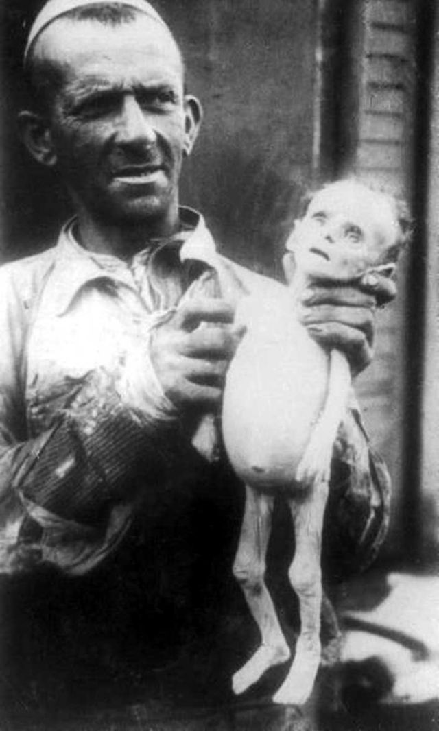 Varşova Gettosu’nda açlıktan ölmüş bir bebek ve babası.