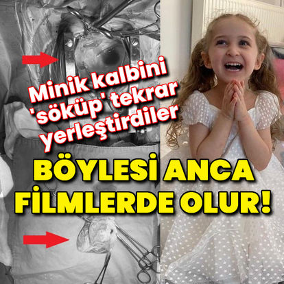 Dünyada bir ilk: Böylesi anca filmlerde olur! Minik kalbini 'söküp' tümörü temizleyip tekrar yerleştirdiler - Güncel haberler