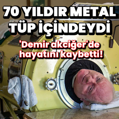 Paul Alexander demir akciğerde yaşıyordu! Tüpte yaşayan Paul Alexander 78 yaşında hayatını kaybetti! - Haberler