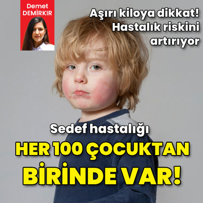 Her 100 çocuktan birinde sedef hastalığı var! - Haberler