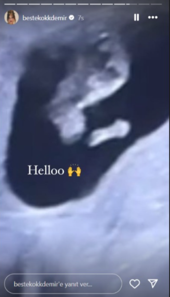 .png