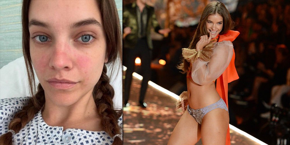 Barbara Palvin ameliyat oldu