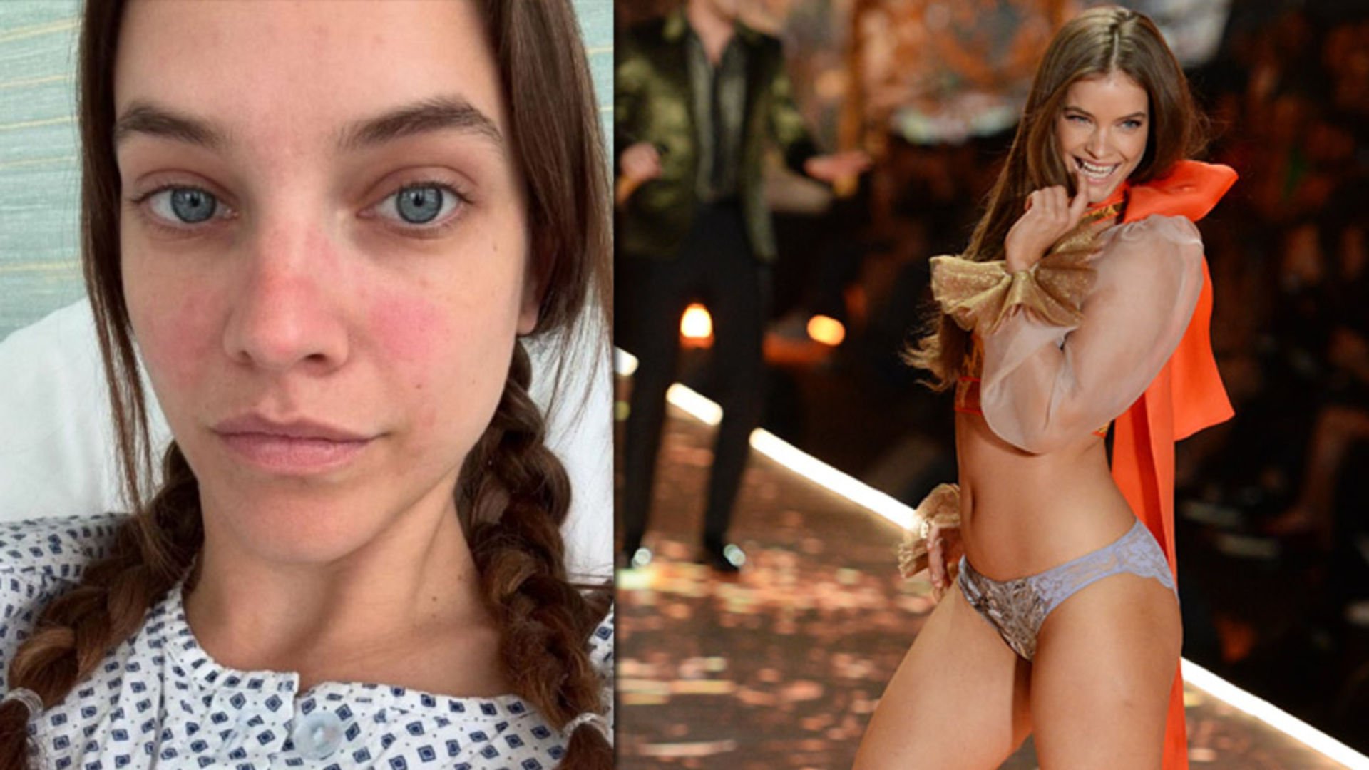 Barbara Palvin ameliyat oldu