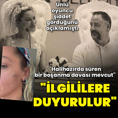 Darp iddialarına yanıt