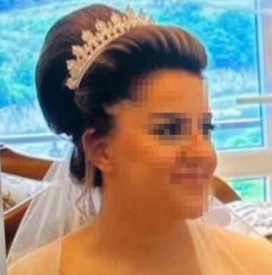 Saldırıda Elif Ç.'nin dizinin parçalandığı öğrenildi.