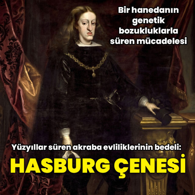 Yüzyıllar süren akraba evliliklerinin bedeli ‘Habsburg çenesi’ oldu