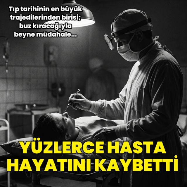 Buz kıracağıyla beyne müdahale eden doktor: Walter Freeman