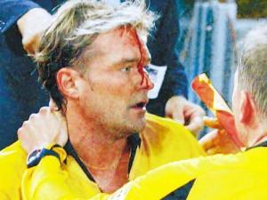 Kafasına isabet alan bir diğer hakem Frisk oldu. 2004'te oynanan Roma-Dynamo Kyiv maçında İsveçli hakem Anders Frisk kafasına isabet almaktan kurtulamadı.