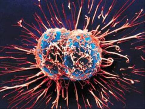 Uzmanlar ayrıca söz konusu belirtilerden hangisinin hangi yaş grubu için kanser yarattığını da inceledi. Bunun için bu alanda daha önce yapılmış olan 25 araştırmanın sonuçları kullanıldı. Hasta 55 yaş altındaysa riskleri 'yirmide bir' eşiğine getiren sadece iki belirti var. Bunlar prostat muayenesinde anormal sonuçlar çıkması ve memede kütle. 55 yaşın üzerindekiler için yutkunma zorluğunun gırtlak kanseri habercisi olabileceği belirlendi ama bu sadece erkekler için geçerli. Buna karşılık idrarda kan 60 yaşın üzerindeki hem kadın hem de erkekler için kaygı unsuru.