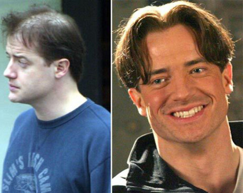 Brendan Fraser