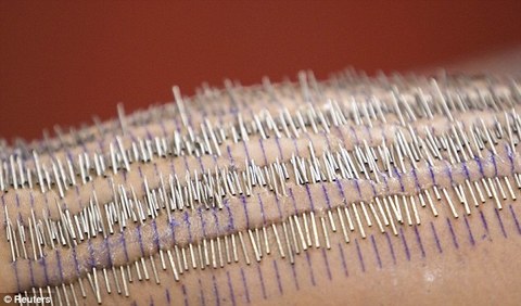 Bacak, kol, sırt ve kalçasına 3 bin 200 piercing taktıran Randall, Guinness'e girmeye hak kazandı.