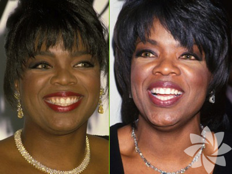 Oprah Winfrey
