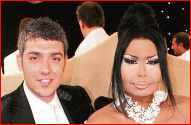 Ersoy ise Uzun'u aciz ve donanımsız olmakla suçlamış "Kendisi hâlâ koyduğum yerde otluyor. Neymiş ben ona albüm sözü vermişim. Demek ki sen bu evliliği bunun için kabul ettin, kendini sattın. Kendisini tanıdığımda Torbalı'da 100-150 liraya düğünlerde klavye çalıyordu. Neymiş benden boşanırken bir şey istememiş. Almak istedi ama ben vermedim. Onun bir de konuşma yasağı var ve bunu ihlal ediyor. Dikkat etsin de kendisine yüklü miktarda bir tazminat davası açmayayım. Adamın ayağından donunu bile alırım yoksa. Ayrıca ben onun Seda Sayan'ın programında yılan gibi kıvırdığı dansını daha önce görseydim onu zaten kendime koca etmezdim" dedi. -