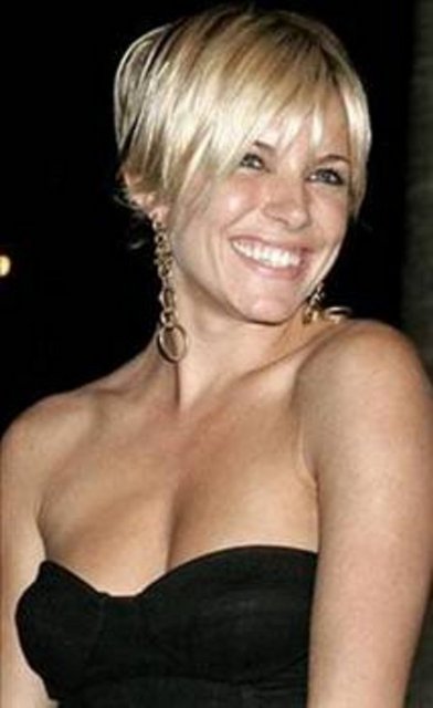 Bir patlama sahnesinde yanlış yöne koşan Miller'ın göğsünde küçük bir yanık oluştu.