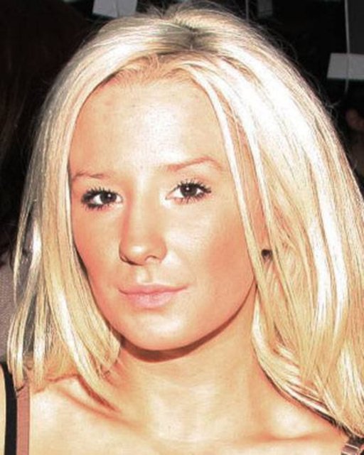 Estetik faciaları! - İsveçli Alexandra "Kissi Nilsson, 20 yaşında yaptırdığı 12 ayrı plastik cerrahi ameliyatıyla gündemde...