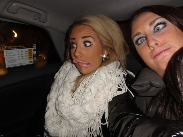 20 yaşında yaptırdığı 12 ayrı plastik cerrahi ameliyatıyla ünlenen İsveçli Alexandra "Kissie" Nilsson, her anını fotoğraflayarak Facebook'ta paylaşıyor.