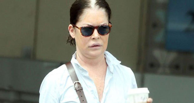 Hollywood ünlülerinden Lara Flynn Boyle da estetik kurbanı oldu. Geçip giden yılların izlerini estetik müdahalelerle silmeye çalışan 45 yaşındaki Lara Flynn Boyle'un yüzü tanınmayacak hale geldi.