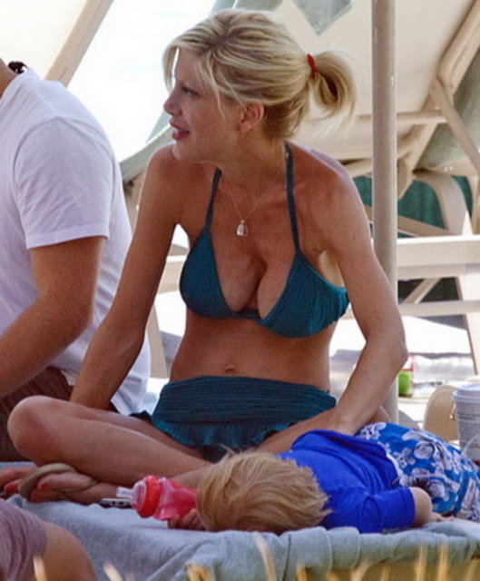 Tori Speling'in sol göğüs implantı çöktü.