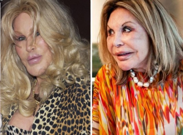 Jocelyn Wİldentstein