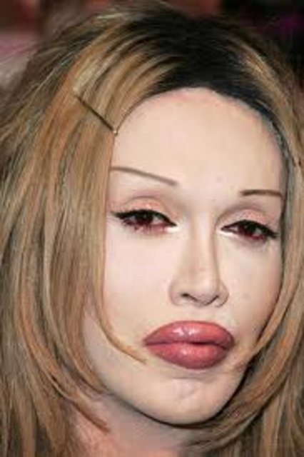 Pete Burns