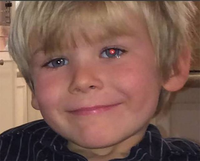 Parlak ışıkla çekilen fotoğraflarda eğer sadece bir gözünüz kırmızı çıkıyorsa göz kanseri olma riskiniz yüksektir.