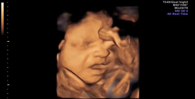 Ultrason çocuk için zararlı mı?Ultrason, görsel şov gibi algılanmamalı, kapsamlı 3 muayene normal olduğu gibi, doktor isterse fazladan olabilir.