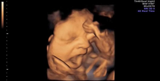 İlk defa ne zaman hareket edecek?İlk hamilelikle 20. haftada, ikinci hamilelikte ya da ikiz bebek beklerken 18. haftada hareket beklenebilir.