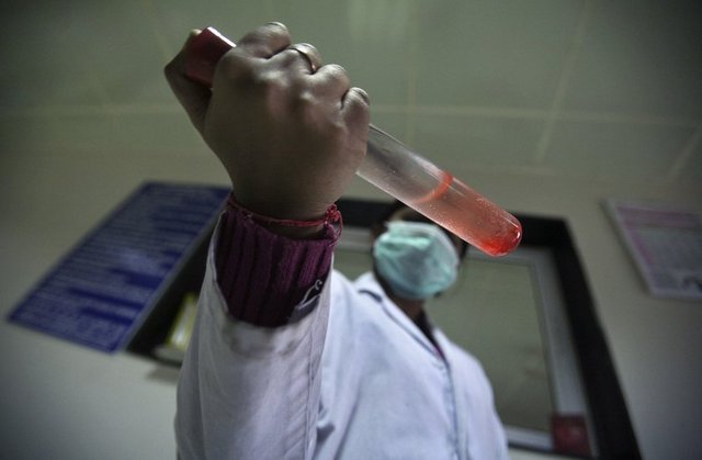 Bir ailede birden fazla engellinin yer almasının genetik özellikler taşıyabileceğine dikkat çeken Keser, "Engelin genetik temele dayanıp dayanmadığının iyi araştırılması ve sonuca göre ikinci çocuğun düşünülmesi gerekiyor." dedi.