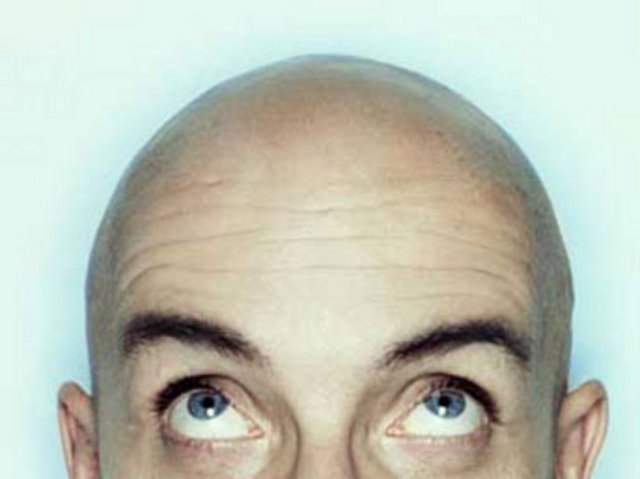 Kel insanlardan korkma (peladofobi)