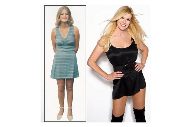 Garip özellikleri Guinness Rekorlar Kitabına girmelerini sağladı. Sahip oldukları ilginç özellikler görenleri şaşırtıyor. 57 yaşındaki Cindy Jackson en çok estetik ameliyat geçirmiş insan olarak biliniyor. Jackson ameliyatlarına £62,000 harcamış.