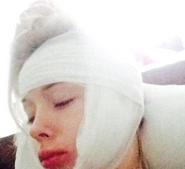 28 yaşındaki Lukyavona, evine yaklaştığı sırada saldırıya uğradığını yüzünden yaralandığını ve dudağının da patladığını ileri sürmüştü.