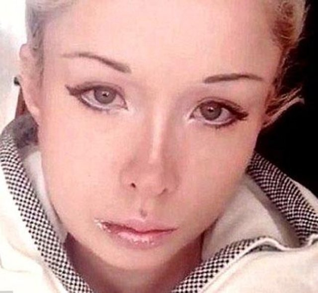 İki yıldır kendisine yönelik bir tehdit kampanyası yürütüldüğünü söyleyen Valeria Lukyavona "Aslında kimsenin saldırısına uğramadı. Estetik operasyon geçirdi" iddialarını da yalanlamıştı.