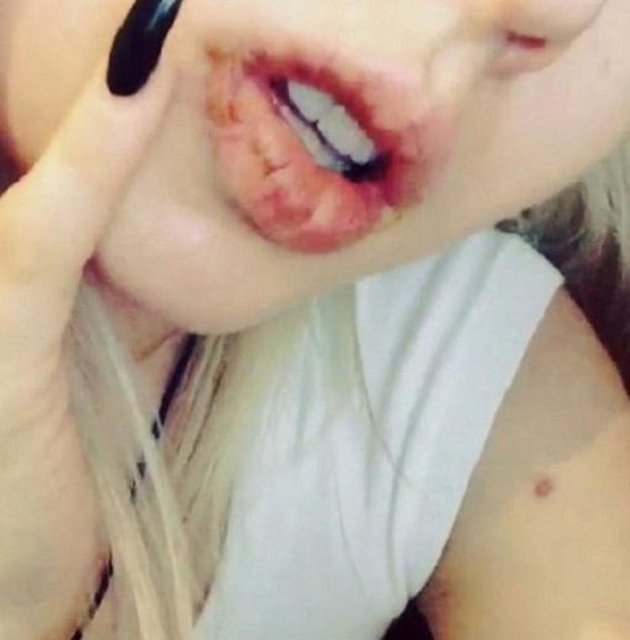 Lukyavona "Apartmanın girişinde saldırıya uğradım. Tam kapıyı açmak için kapı kilidinin kodunu girdiğim sırada iki kişi bana saldırdı" dedi.