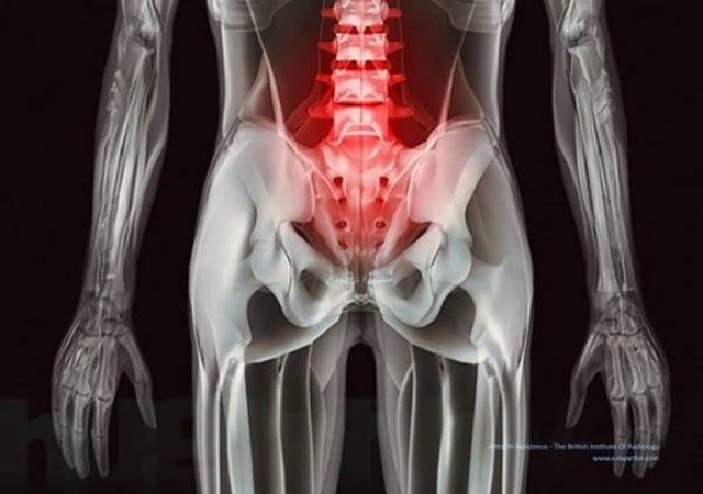 Belinizi incittiğinizde x-ray'e bu şekilde yansıyor