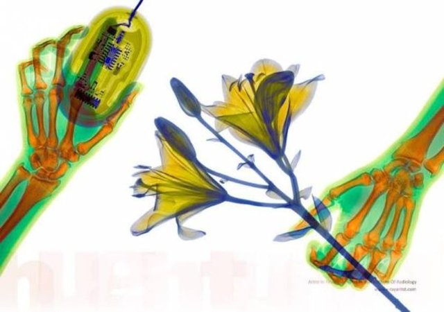 X-ray altında çiçeğin görüntüsü