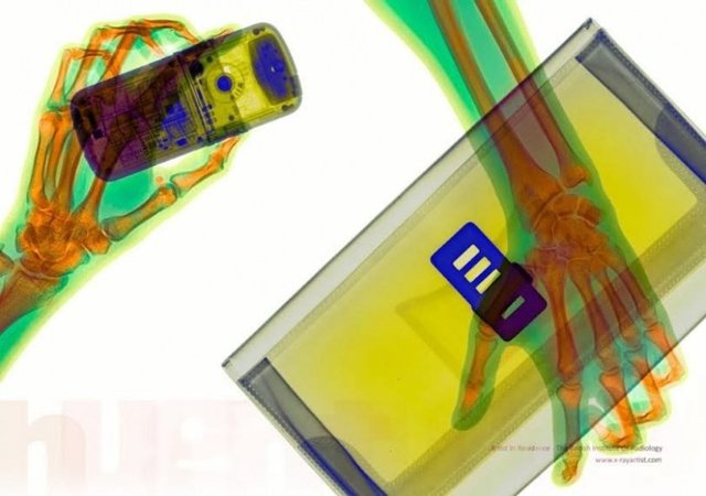 X-ray altında cep telefonu